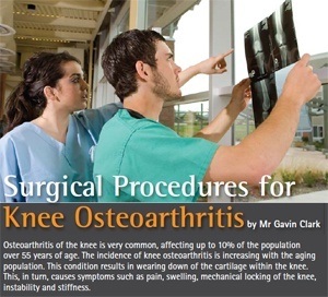 Surgical Procedures for Knee Osteoarthritisby Mr Gavin Clark